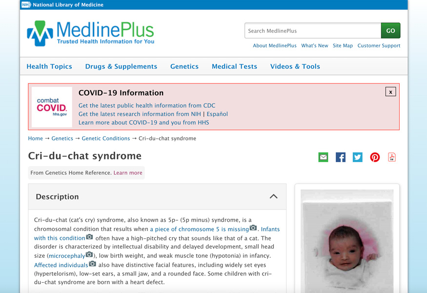 MedlinePlus_Cri-du-chat-syndrome