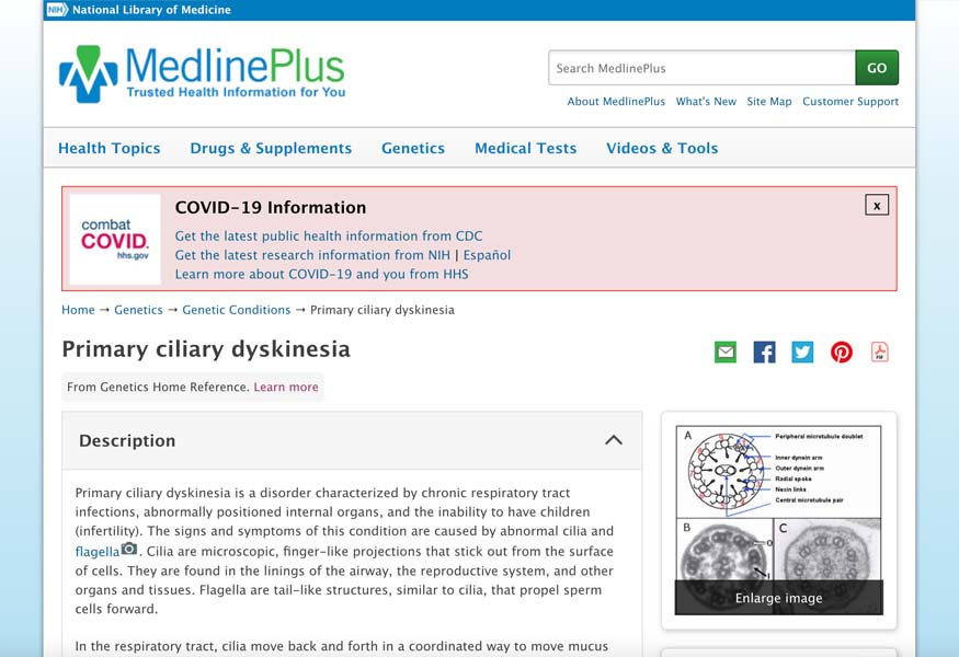 MedlinePlus_Primary-ciliary-dyskinesia